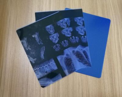 China Blue Polyester Roll Laser Printing (PET) Medical X Ray Imaging Film for sale