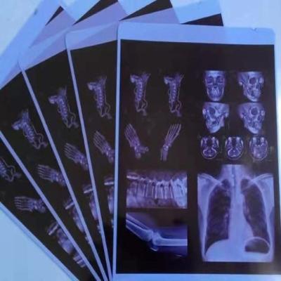 China Waterproof Inkjet Laser X-Ray Film Blue / White Film For Medical Image for sale