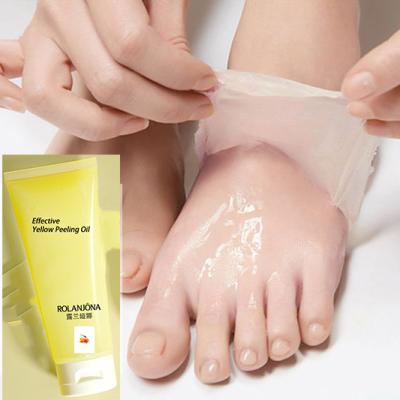 China Natural Foot Whitening Remove Skin Layer Dark Knuckles Most Effective Yellow Skin Oil for sale