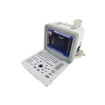 China Metal See Laptop B W Portable Pregnancy Doppler Probe Scanner Radio Fetal Ultrasound Machine For Baby for sale