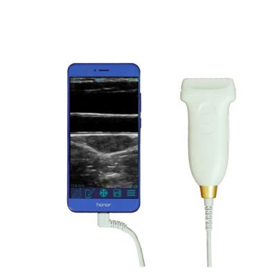 中国 GYN ultrasound probe convex wifi usb wireless ultrasound probes for android 販売のため