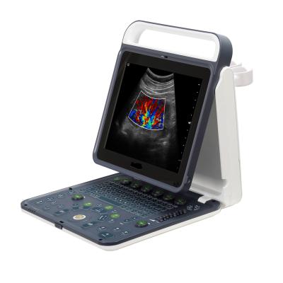 China Hospital Outside 2020 New Portable Digital 15 Inch Color Doppler Ultrasound Machine for sale