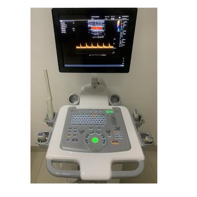 中国 Hospital Outside Trolley 15Inch Ultrasound Machine Ultrasound Digital Color Doppler Ultrasound Machines edical 販売のため