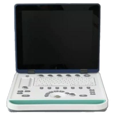 中国 Hospital Outside 2D 3D Notebook Full Digital Color Doppler Ultrasound Diagnostic System Ultrasound Machine 販売のため