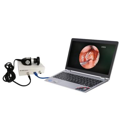 China All usb endoscopic surgical endoscope hd factory price waterproof inspection camera for sale