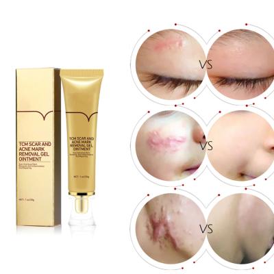 China Remove Acne Scar Treatment Cream Repair Cream Remove Acne Scar Treatment Face Whitening Cream Pimple Scar Body Skin Cream for sale