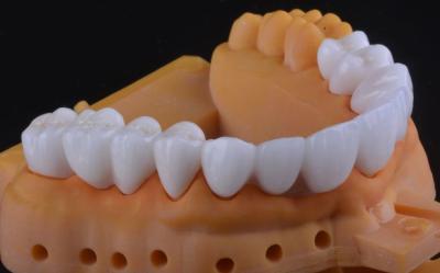 China High Strength Zirconia Tooth Crown Ultra Translucent With Long Term Stable for sale