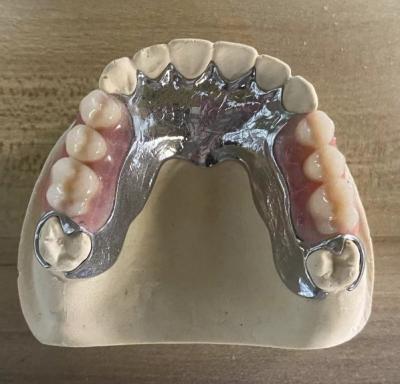 China High Strength Casting Metal Partial Denture Cocr Aolly With 3D Printing for sale