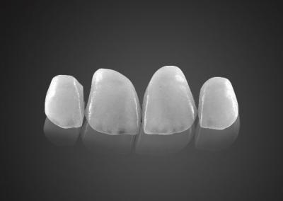 China IPS 0.2mm Ultra Thin Emax Veneers Stain Resistant With High Strength for sale