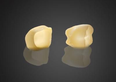 Chine 1440 Mpa Haute stabilité 3M Lave esthétique Zirconia personnalisable pour les dents postérieures à vendre