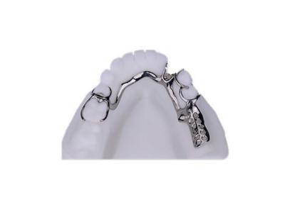 China Customized Fit Metal Frame Denture Natural looking Full Arch Shape for sale