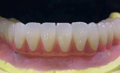 China Coronas dentales de zirconia personalizadas resistentes a las manchas con alta precisión en venta