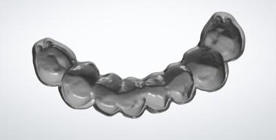 China Concha de huevo fresada CAD CAM Diseño dental para el implante de puente temporal PMMA en venta