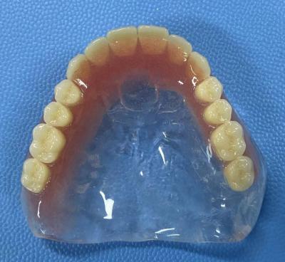 China Stain Resistance Full Acrylic Denture High Stability with Full Arch Shape for sale