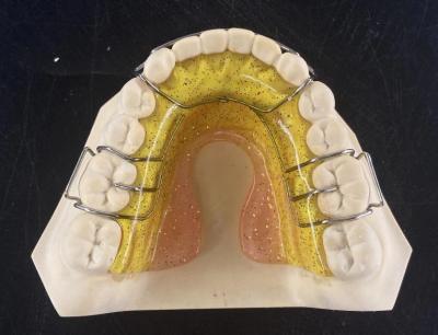 China Draagbare Hawley orthodontische retainer langdurig met glad oppervlak Te koop