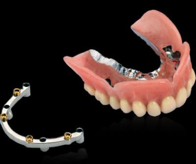 China Parafuso de barras de implantes dentários de titânio moído com superfície polida lisa à venda