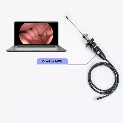 China Cámara de endoscopio USB portátil eléctrica Full HD CMOS para ENT Otoscopio nasal Oído Ginecología laparoscópica en venta