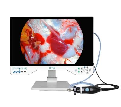 Chine Système de caméra ENT tout en un avec caméra HD endoscopique portable et source lumineuse à vendre