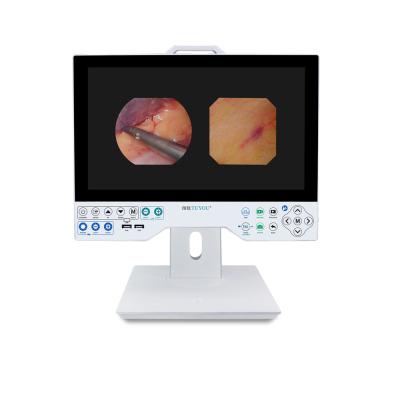 China TUYOU Full HD 1080P 15,6 polegadas All In One Sistema de Câmera de Endoscopia Médica para ENT Sinus Urologia à venda