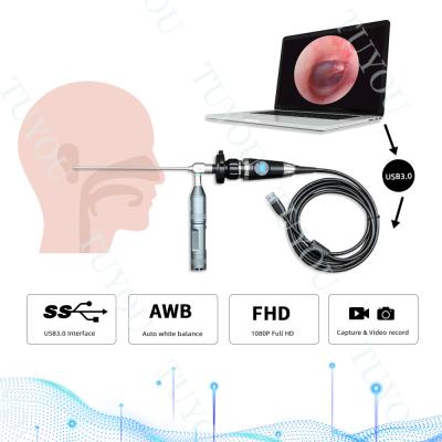 중국 휴대용 USB3.0 내시경 손잡이 카메라 의료 외과 검사 판매용