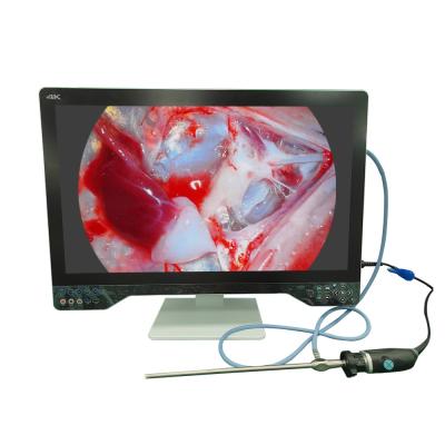 China Cámara de endoscopio de ultra alta definición 4K para laparoscopia con monitor de 32 pulgadas y fuente de luz en venta