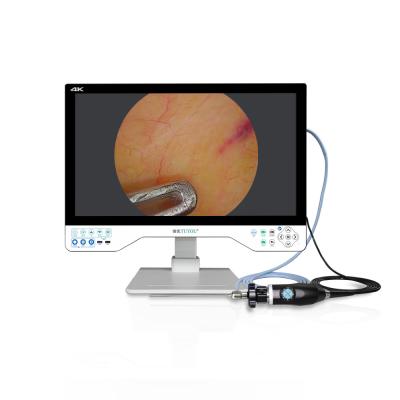 China Sistema de cámara de endoscopio 4K UHD con grabadora de vídeo USB 24 pulgadas monitor laparoscópico LED quirúrgico y fuente de luz en venta