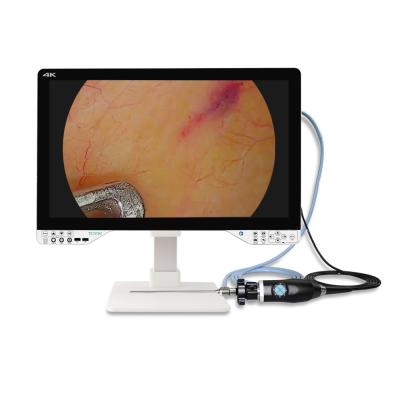 Chine 27 pouces Endoscope 4K pour chirurgie laparoscopique avec source lumineuse et moniteur à vendre