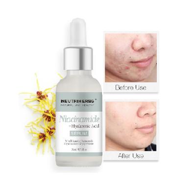 China Wholesale Niacinamide Skin Revitalizer Relieve Redness Treatment Private Label Acne Removal Serum for sale