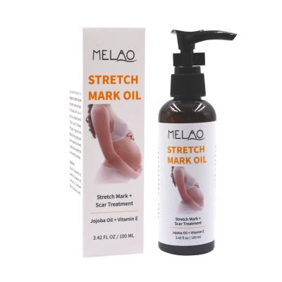 China Anti Aging Skin Care Oil For Scars And Stretch Marks Natural Mild Herbal Ingredients Best For Pregnancy Stretch Mark for sale