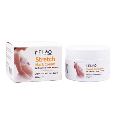 China Natural Organic Pregnancy Abdomen Scar Repair Anti Pregnancy Abdomen Scar Repair Natural Organic Revitalizer Private Label Stretchmark Remover Cream Body Stretch Mark Cream for sale