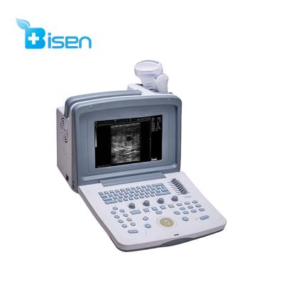 China BS-9618 Fully Digital Plastic Portable Mode B Ultrasonic Diagnostic System / Machine Ultrasound Scanner for sale