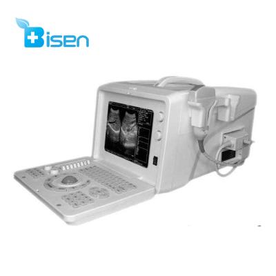 China BS-SS-5 Plus Cheaper All Portable Digital B/W Ultrasound Machine BS-SS-5 for sale