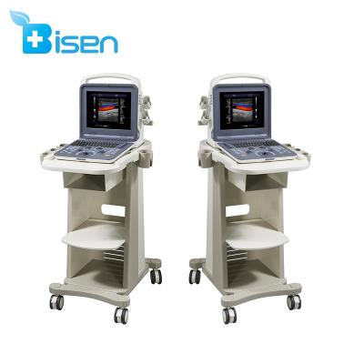 China BS-K6 Obstetrics Laptop 4D Color Doppler Intelligent Upper Block Portable Ultrasound With Touch Screen for sale