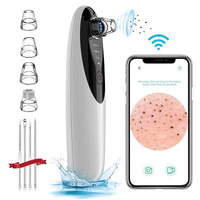 China Portable Nose Whiteheads Blackheads Nose Whitehead Removal Acne Treatment Vacuum Blackhead Facial Remover For Home Use for sale