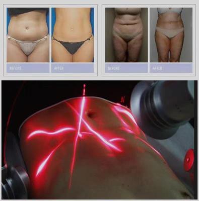 China Weight Loss 6D 532nm Noninvasive Slimming Machine For Full Body Shape 200mw Laser Slim Beauty Equipment Fat Burning for sale