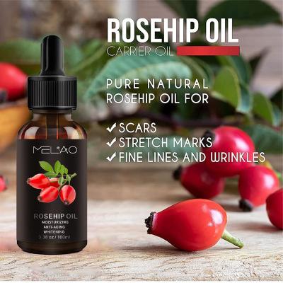 China Skin Revitalizer 2022 Hot Selling Organic Pure Cold Pressed Private Label Rosehip Oil Stretch Anti Whitening Nourishing Rosehip Oil Bulk for sale