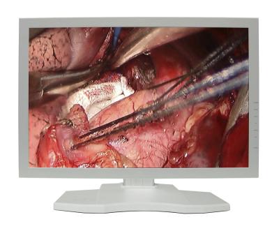 China Full Metal HD 1080P 19/24/27 Inch LCD Medical Grade Endoscopic Monitor for sale