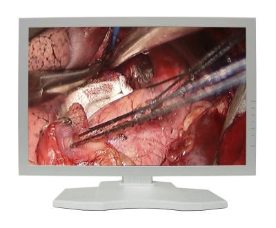 China Metal 24 Inch 1080P Endoscope Camera Parts Widescreen Medical LCD Monitor Inspection Endoscope Camera for sale