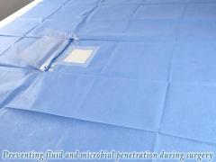 Surgical Eye Drape