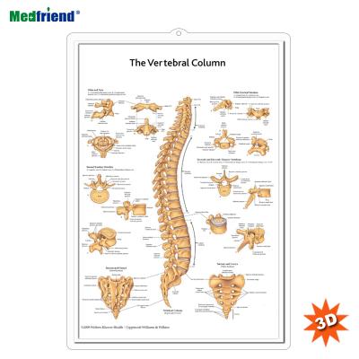 China PVC Material Authorized Educational Plastic Medical Anatomical Chart /Poster - 3D Wall Spine for sale