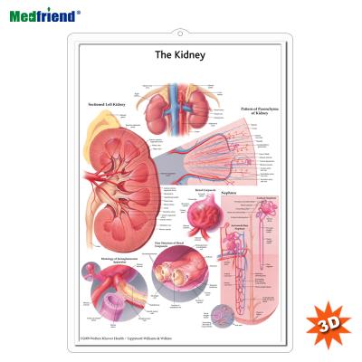 China PVC Material Authorized Educational Plastic Medical Anatomical Chart /Poster - 3D Wall Kidney for sale