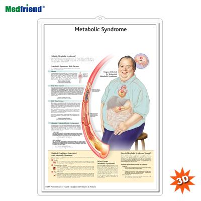 China PVC Material Authorized Educational Plastic Medical Anatomical Chart /Poster - 3D Wall Metabolic Syndrome for sale