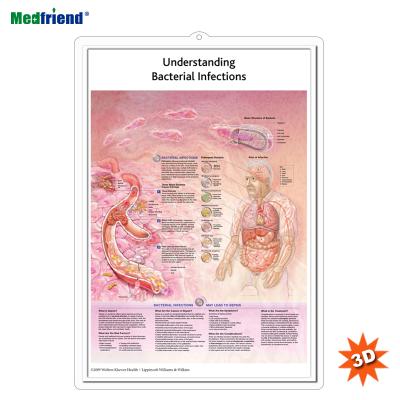 China PVC Material Authorized Educational Plastic Medical Anatomical Chart /Poster - 3D Wall Bacterial Infections for sale