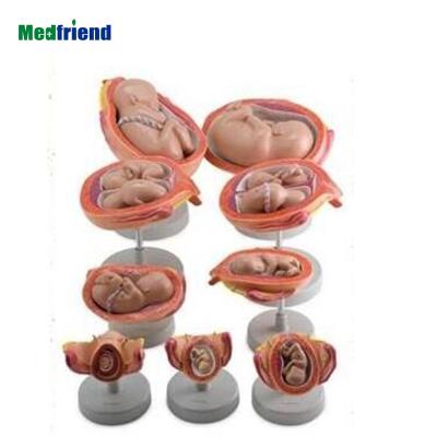 China Patients Care Demonstration Factory Price Anatomical Human Medical Fetus Development Model 8 Series for sale