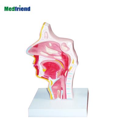 China Patients Care ENT Inflammation Demonstration Factory Price Advanced Anatomical Model for sale