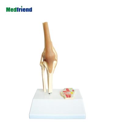 China Patients Care Demonstration Factory Price Life Size Knee Joint And Ligment Attached With Sagittal Section for sale