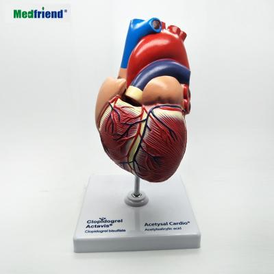 China Patients Care Anatomical Heart Model Anatomical Medical Demonstration Cutaway 2 Part for sale