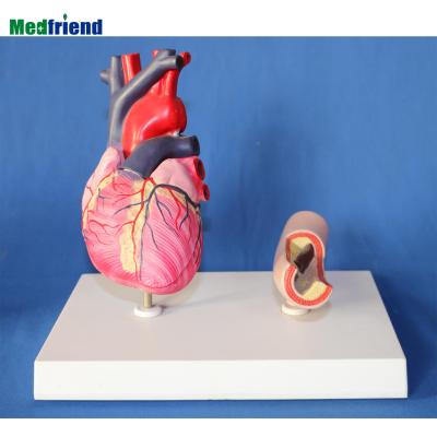 China Patient Care Demonstration Heart Model Removable Human Heart Anatomical Structure With Atherosclerosis Anatomical Heart Model for sale