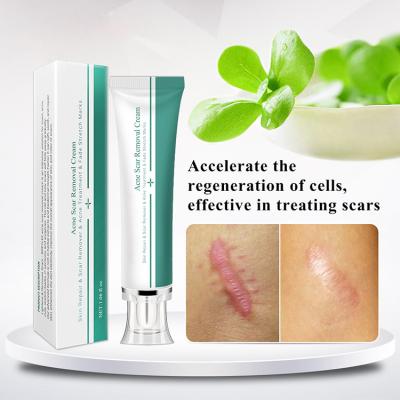 China Whitening Private Label Acne Scar Removing Cream Scar Gel Bruises Repair Cream Acne Treatment Tightening Stretch Mark Scar Removal Cream for sale