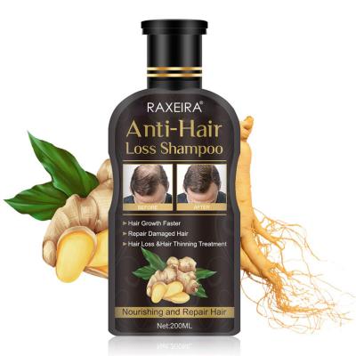 China Wholesale Anti Hair Loss Prevention Hair Loss Shampoo Promotes Thicker, Faster Growing Hair For Men And Women for sale